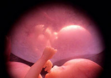 Bambino in posizione fetale ancora nell'utero.