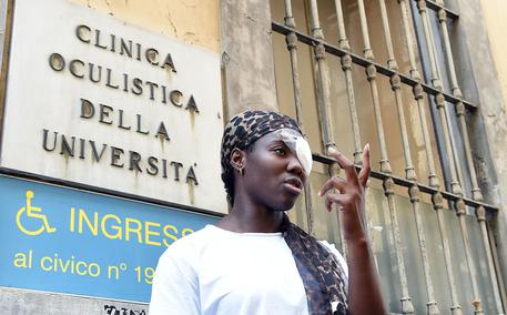 Daisy Osakue giovane atleta di origine nigeriana ferita ad un occhio lanciato da un'auto in corsa a Monclaieri, Torino, fotografata sulla porta della Clinica oculistica dell'Università.