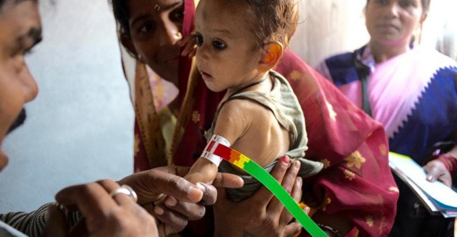 Un bambino magrissimo in braccio alla mamma mentre gli viene misurata la circonferenza del braccio. Malnutrizione