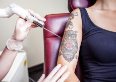 Tatuaggi sul braccio di una ragazza