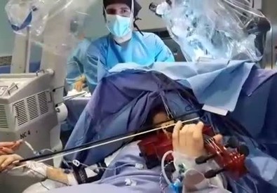 Operata al cervello mentre suona il violino.
