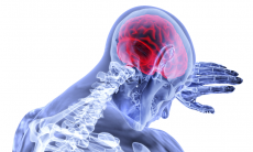 La epilepsia afecta al cerebro