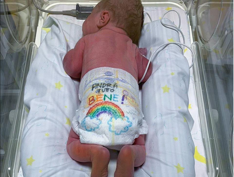 La foto postata dall'associazione di Neonatologia del Niguarda con il bimbo con il pannolino arcobaleno.