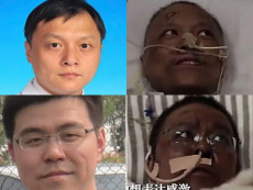 Grafica con i due medici cinesi Yi Fan (sopra) e Hu Weifeng,(sotto) "diventati" neri per effetto di farmaci sul fegato.