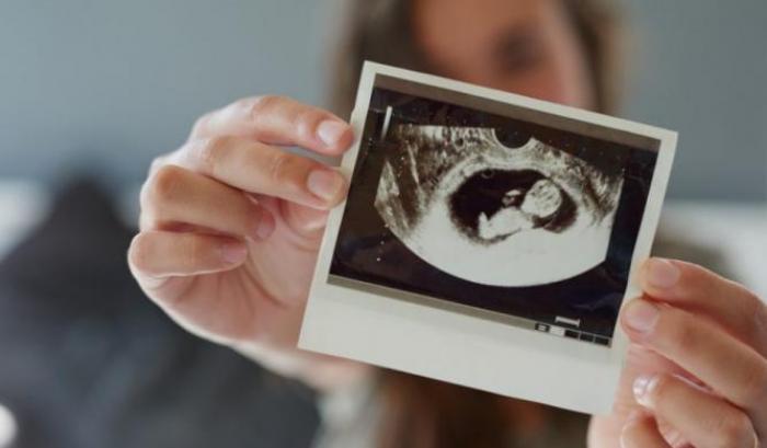 Donna mostra foto di un feto