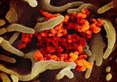 In arancione le particelle virali di SarsCoV2 che emergono da cellule coltivate in laboratorio