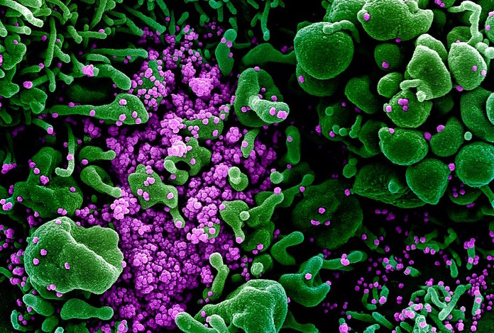 Particelle del virus SarsCoV2 (in violetto) sulla superficie di una cellula (fonte: NIAID)